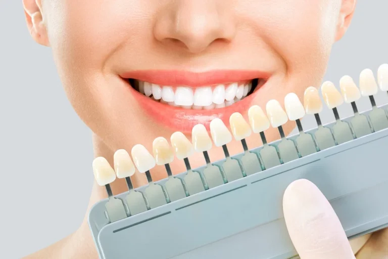 Transform Your Smile with Porcelain Veneers in Ellicott City, MD